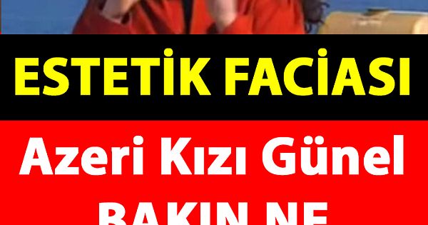 Estetik Yaptırayım Derken Bakın Ne Hale Geldi!