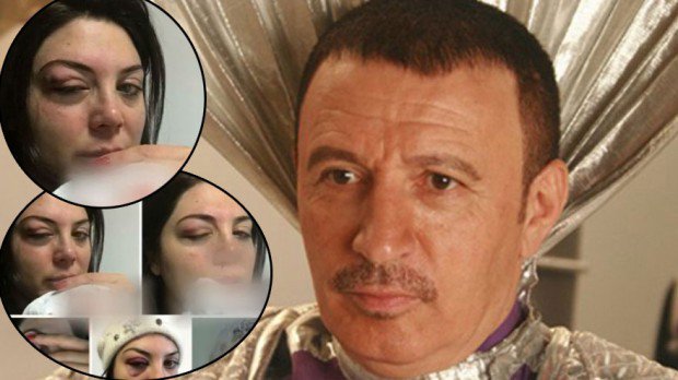 Mustafa Topalo?lu E?i Derya Topalo?lu'na ?iddet Uygulad? ?ddias? 